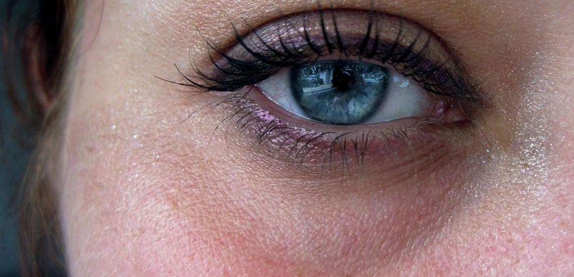 رفع سیاهی دور چشم با ۱۰ روش خانگی
