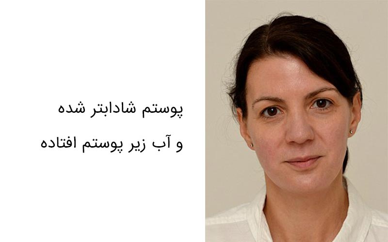 هفته سوم جوان شدن پوست