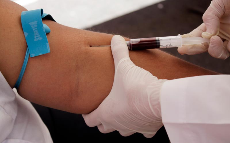 تشخیص کبد چرب چگونه است؟