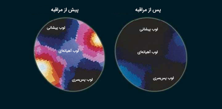 مراقبه چطور باعث آرامش جسمی و روحی ما میشود 1 مراقبه چیست ، تاثیر مراقبه بر مغز