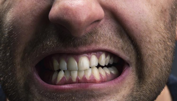 کافه کالا | چگونه از شر دندان قروچه خلاص شویم؟ (2021)