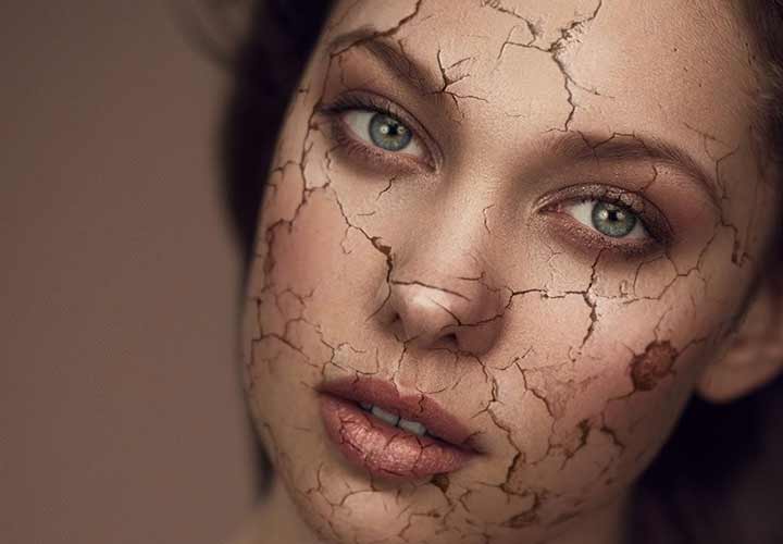 از پوست خشک چگونه مراقبت کنیم؟