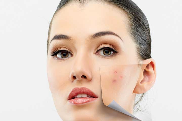 توصیههایی برای پاکسازی صورت از جوش هورمونی
