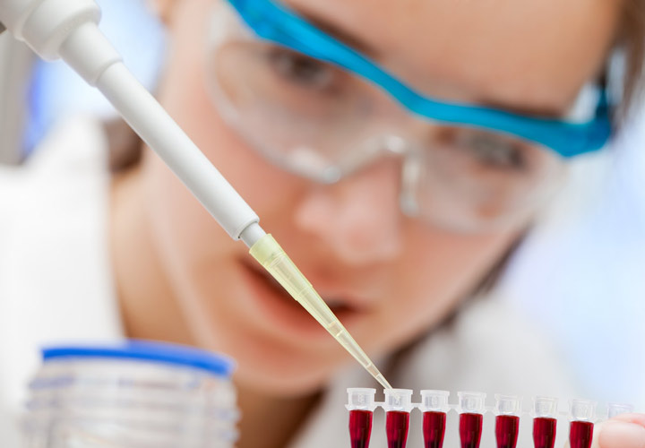 تست خون - سرطان کبد