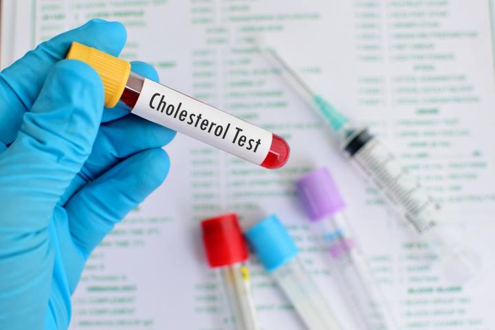 علائم کلسترول بالا - تشخیص بالا بودن سطح کلسترول خون با آزمایش خون