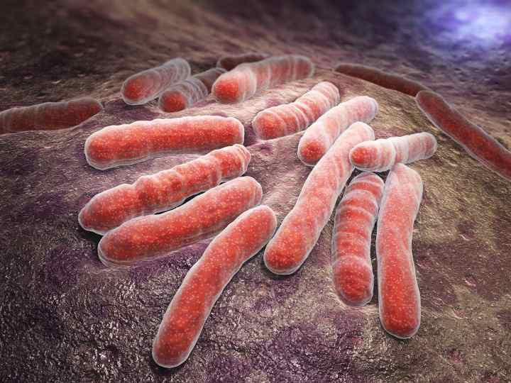 باکتری ای کولای از عوامل ابتلا به اسهال خونی