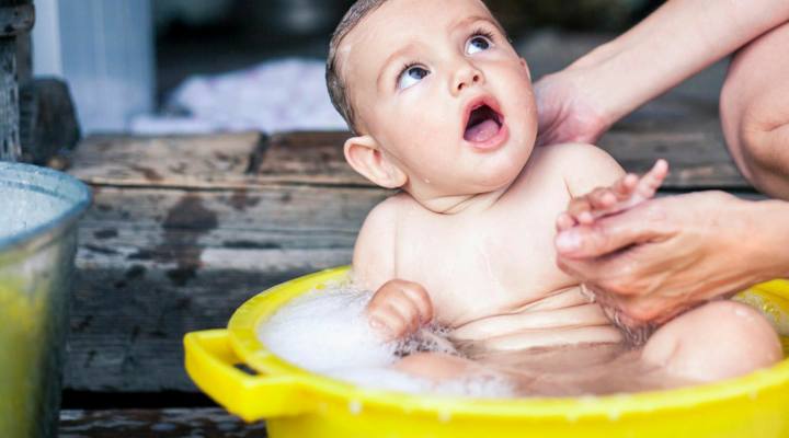 جوش صورت نوزاد - روش های پیشگیری