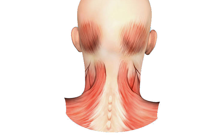 درمان سردرد با ماساژ - ماهیچه های پشت گردن