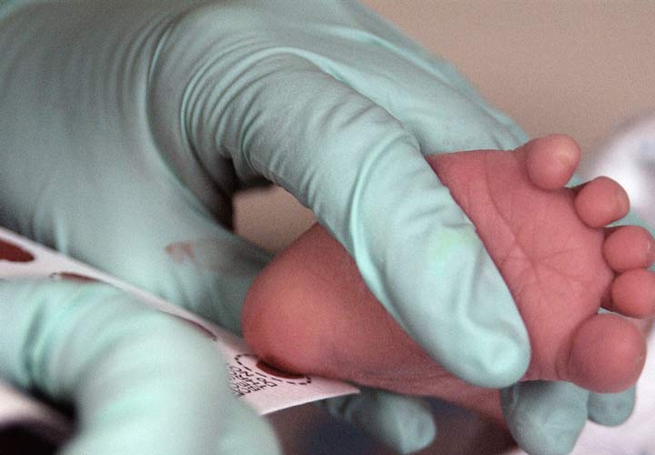 آزمایش غربالگری در نوزادان به تشخیص سیستیک فیبروزیس در آنها کمک می کند.