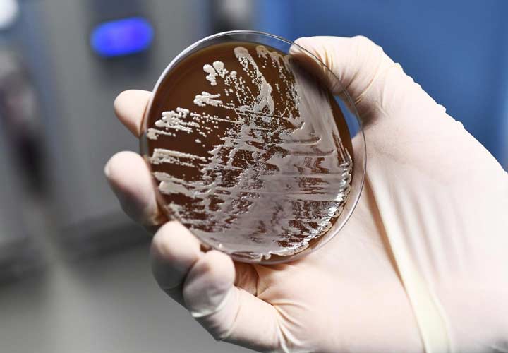 جداسازی و شناسایی ارگانیسم عامل عفونت از محل عفونت می تواند به تشخیص قطعی عامل عفونت کمک بکند. - باکتری گوشتخوار
