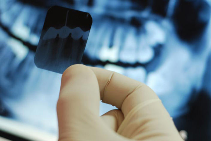 رادیولوژی دندان - هزینه خدمات دندانپزشکی