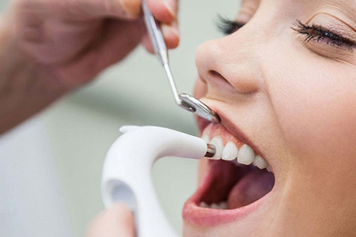 جرم گیری دندان - هزینه خدمات دندانپزشکی