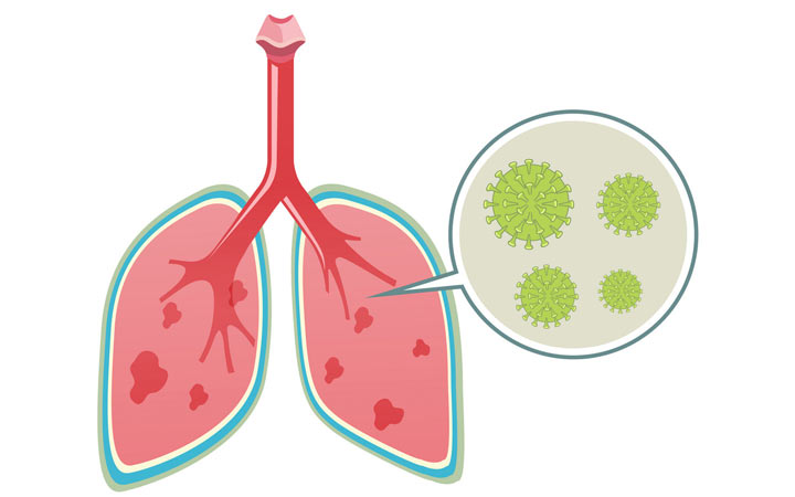 ویروس کرونا با بدن ما چه می‌کند؟ - ریه ها