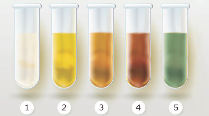 طیف رنگی ادرار - رنگ ادرار کلیه سالم