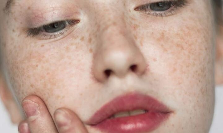استفاده از ماسک زردچوبه برای کاهش لکه های پوستی