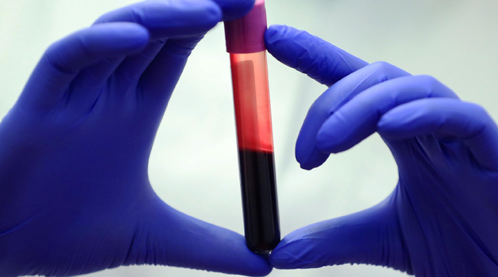 انواع آزمایش خون - آزمایش آنزیم