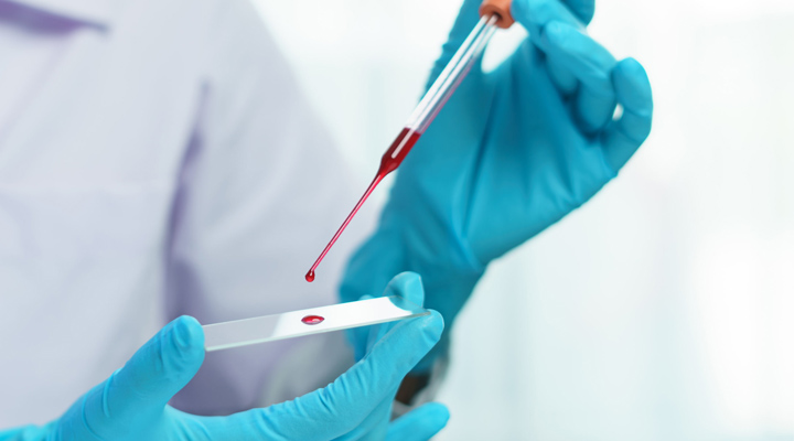 انواع آزمایش خون - متابولیک پایه
