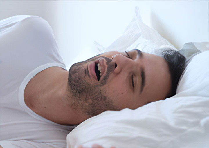 سندروم زیبای خفته؛ علائم، علل و درمان این اختلال خواب 2 سندروم زیبای خفته و بیشتر شدن اشتها