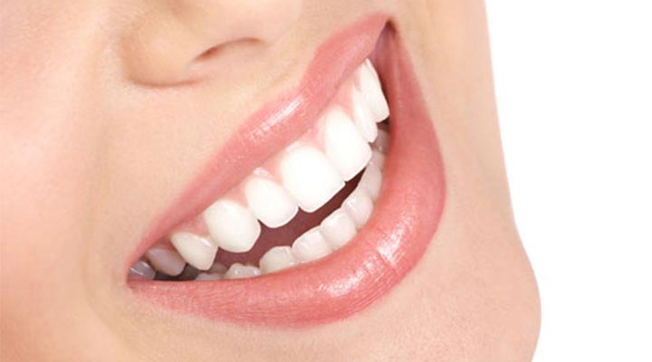 درمان‌های زیبایی دندان