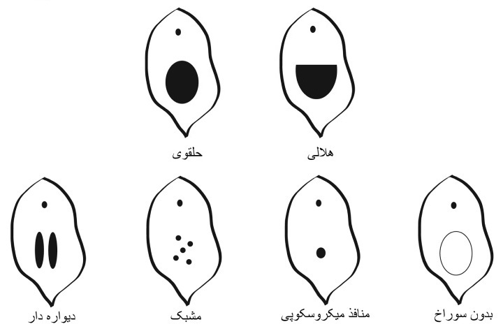 پنج حقیقت مهم از هایمن یا پرده بکارت