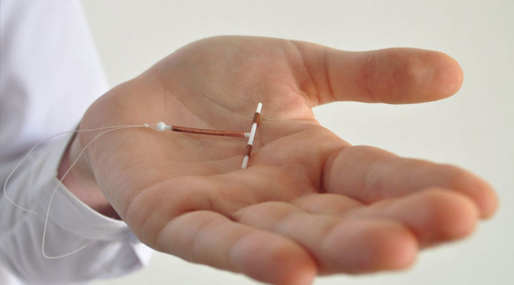 تغییر زمان‌بندی پریودی با IUD