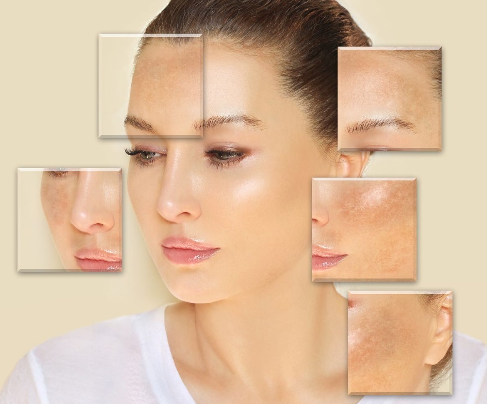 درمان مشکلات پوستی با کوجیک اسید