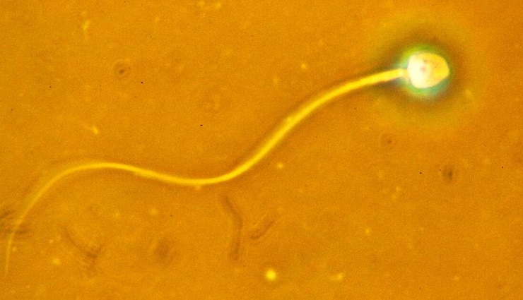 اسپرم زرد در زیر میکروسکوپی