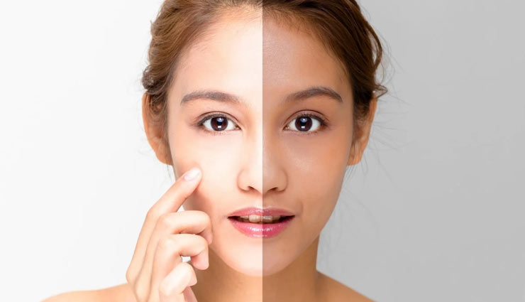 تأثیر احتمالی مصرف کرم روشن کننده پوست