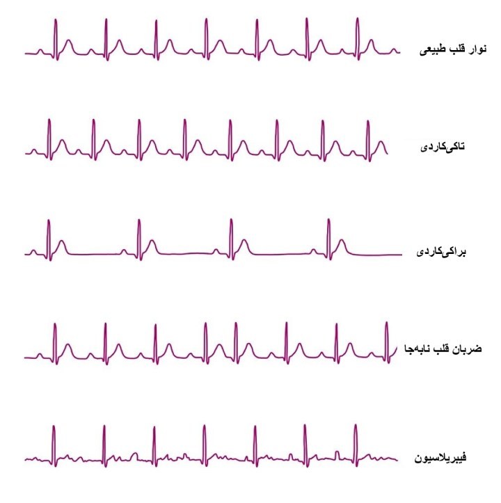 آنچه که در مورد نوار قلب نمی دانید