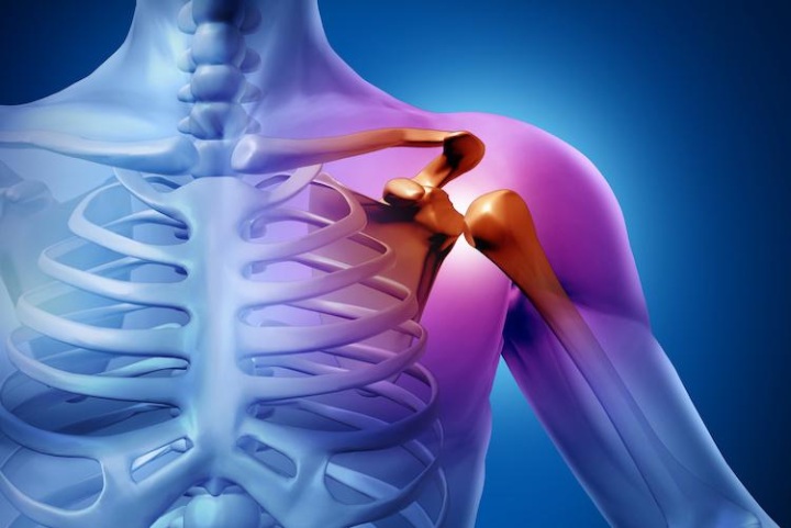 بدترین درد دنیا - شانه یخزده