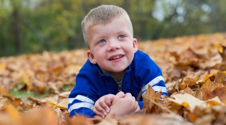 کودکی با چشم‌های آبی کم‌رنگ و افتاده که از علائم سندرم نونان است