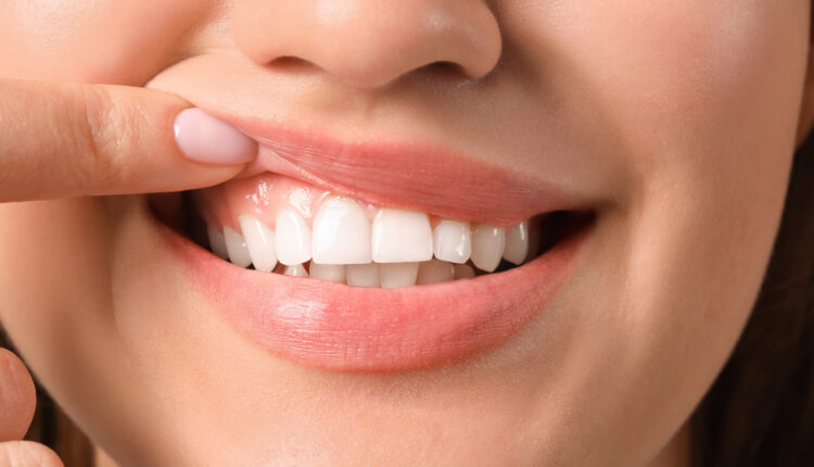 you could see some benefits to your mouth and gum health 1616686509