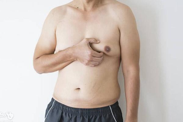 از کجا بفهمیم ژنیکوماستی داریم