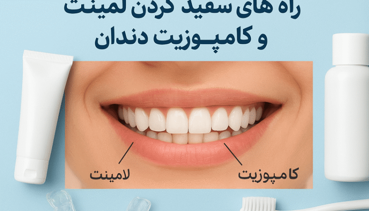 راه های ترمیم و سفید کردن لمینت و کامپوزیت دندان