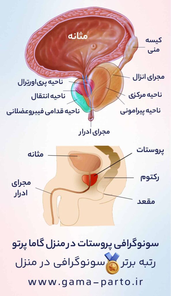 شکل پروستات و پروستات در کجای بدن قرار دارد؟