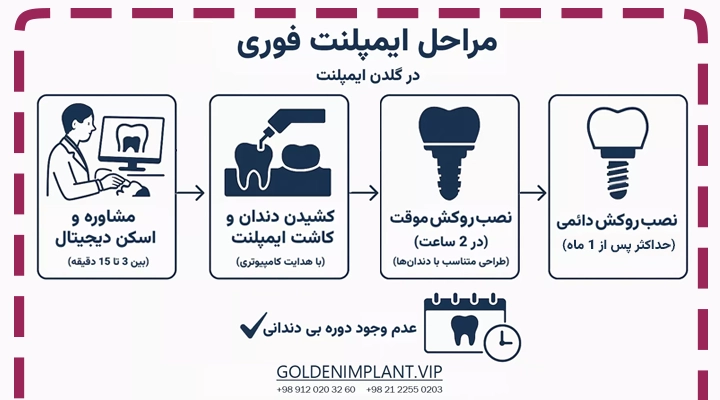 مراحل ایمپلنت فوری _ کاشت دندان یک روزه