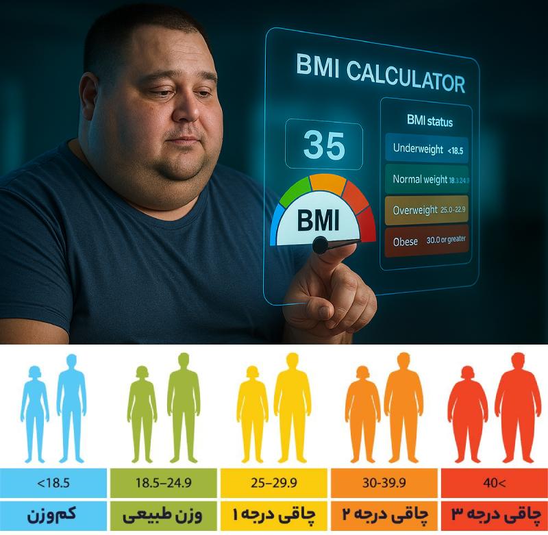 کاندیداهای مناسب برای جراحی‌های چاقی - شاخص توده بندی bmi