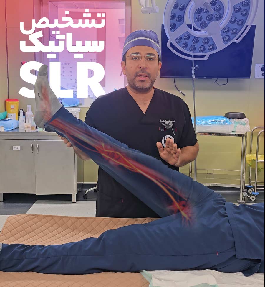تشخیص سیاتیک در خانه با تست SLR
