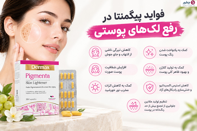 بررسی تاثیر قرص پیگمنتا در رفع لک های پوستی - مجله چطور